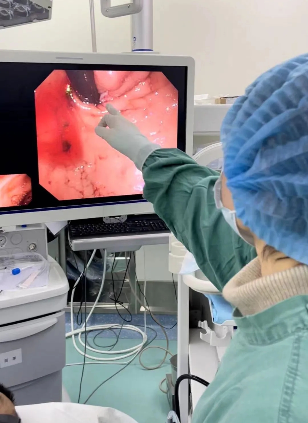 消化道大出血命悬一线 内镜下止血力挽狂澜